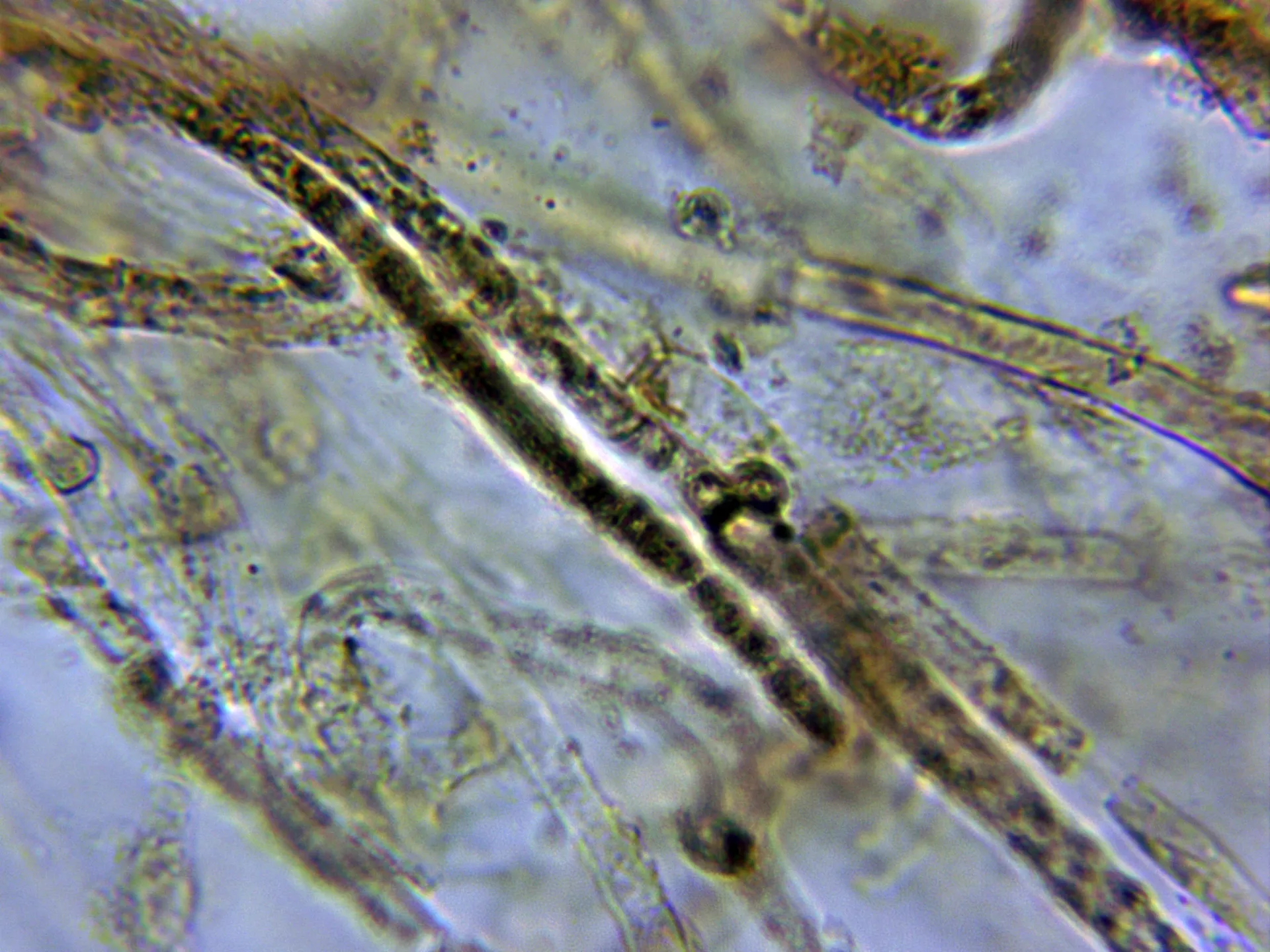 10 - Fíbula suprapellis